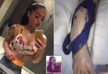 The Unexpected Death: 39-Year-Old Bodybuilder’s Ankle Lump Turns Out To Be Cancer