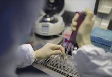 Can Corona Virus be sexually transmitted? Shocking reports suggest Coronavirus being found in Semen. 