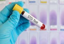 How to Test for STDs at Home?
