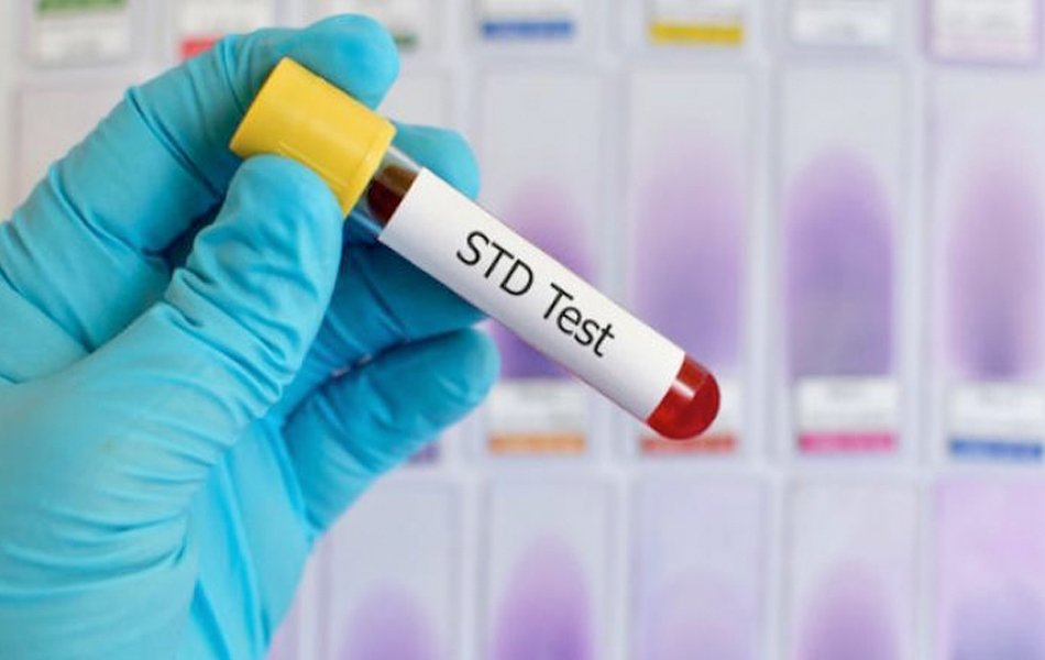 How to Test for STDs at Home? - The Nation Roar