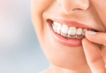 The Magic of Orthodontics: Transforming Smiles and Lives Magic of Orthodontics