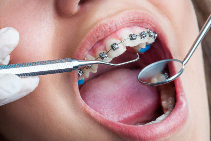 Orthodontic Journey
